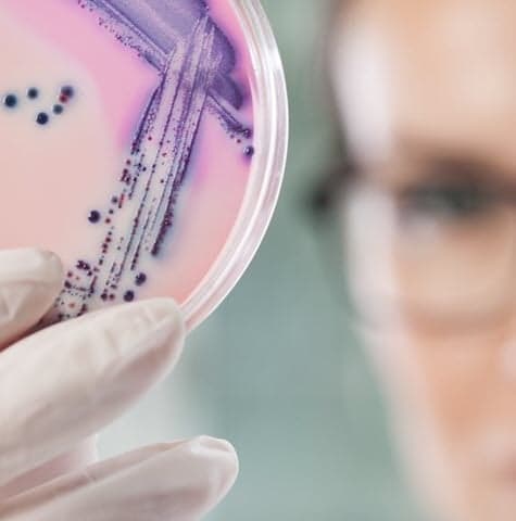 Scientist looking at microbiological sample for quality control testing